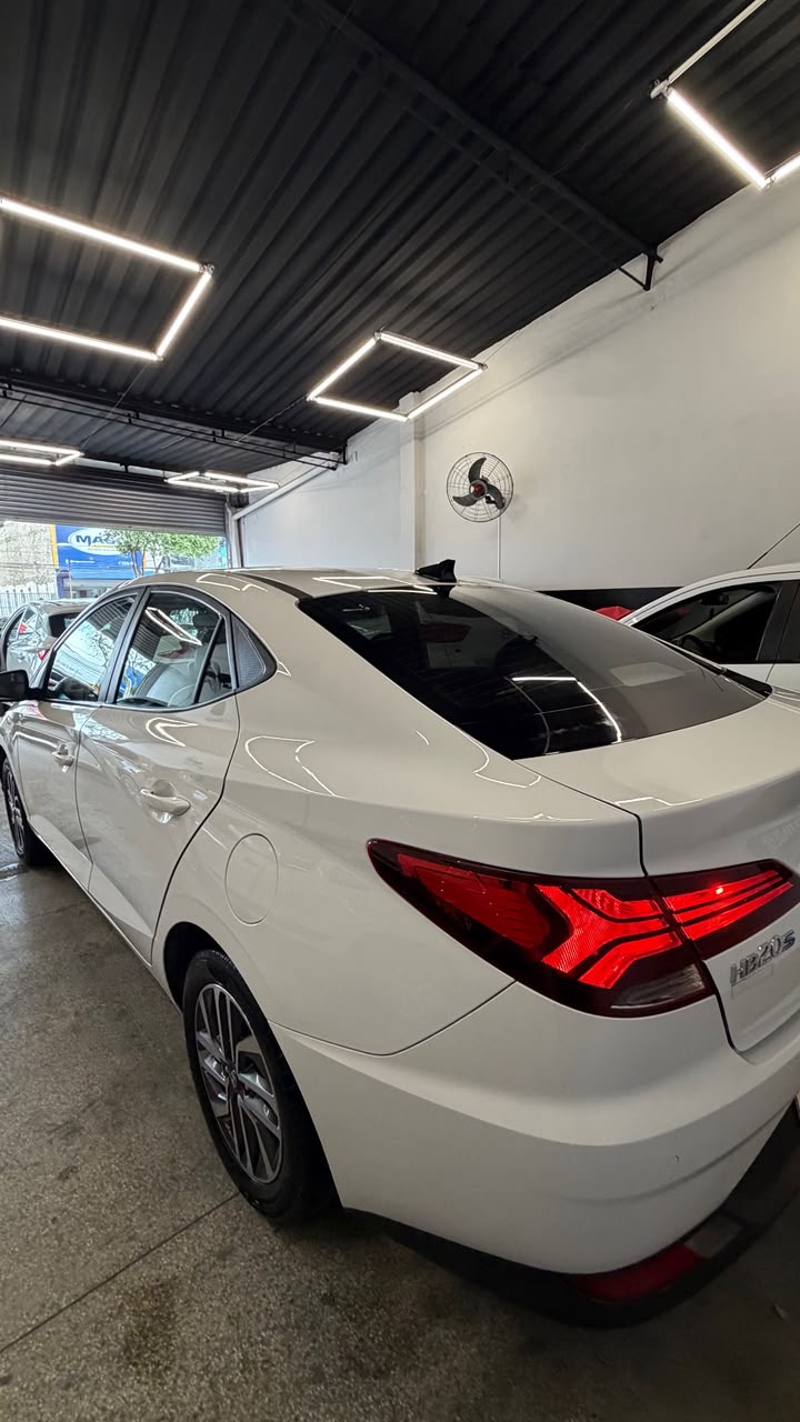 HYUNDAI HB20S 5