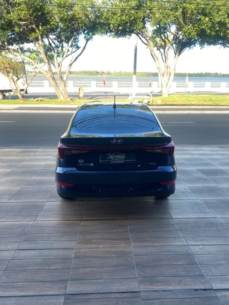Hyundai HB20S 5
