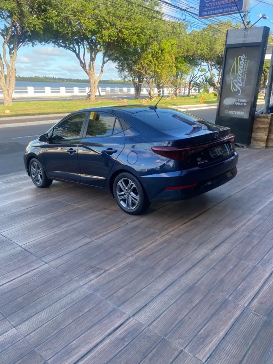 Hyundai HB20S 4