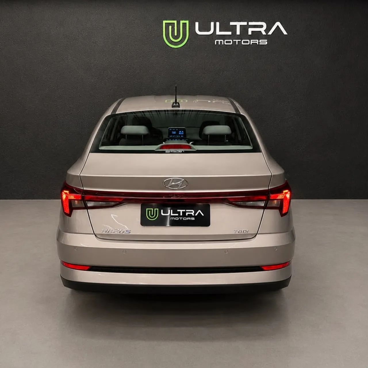Hyundai HB20S 5
